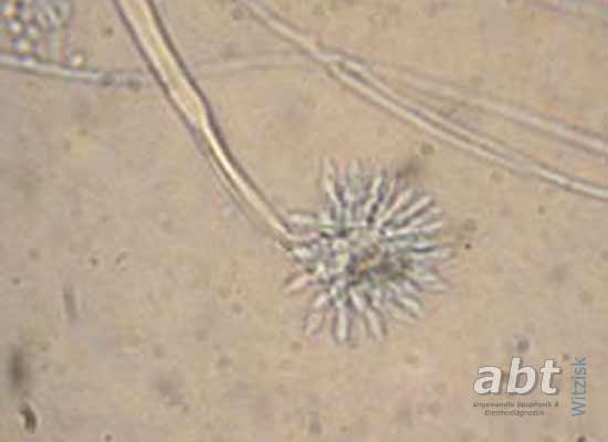 Folien Kontaktproben mit Klebefilm